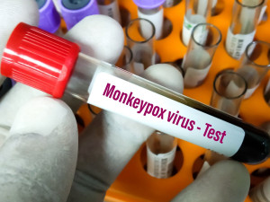 Ευλογιά των πιθήκων: Στα 72 τα κρούσματα στην Ελλάδα