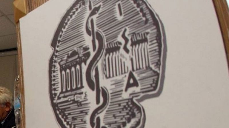 Χωρίς τελειωμό το brain drain γιατρών σύμφωνα με τον ΙΣΑ