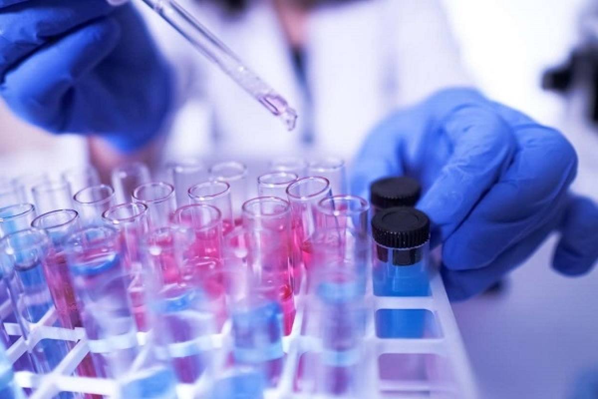 Covid-19: Έλληνες ερευνητές βρίσκονται κοντά σε νέο μοριακό τεστ ανίχνευσης