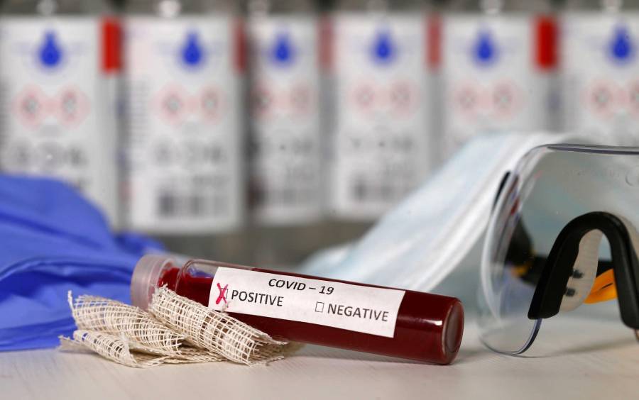 COVID-19: Υπάρχει ελπίδα αντιμετώπισης με την Υδροξυχλωροκίνη;