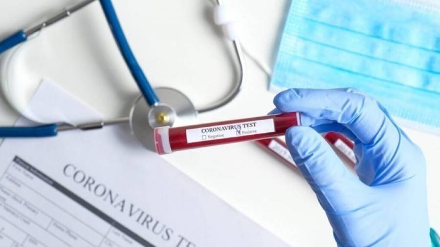 Γεωγραφική κατανομή των κρουσμάτων: 89 στην Αττική-44 στη Θεσσαλονίκη