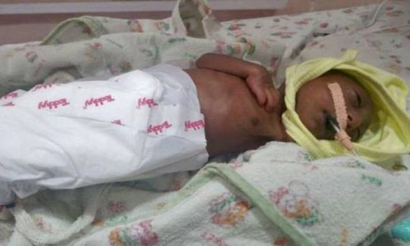 Γονείς – «τέρατα» εγκατέλειψαν το μωρό τους λόγω… εμφάνισης!