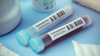 Covid-19: Η Κομισιόν επιλέγει 17 σχέδια για την ανάπτυξη εμβολίων